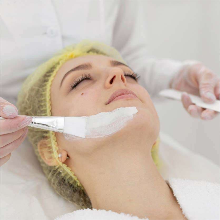 Chemical Peels