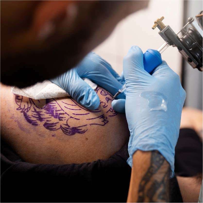 Tattoo Removal in Indore at Skintimacy